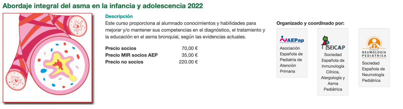 A­bor­da­je in­te­gral del as­ma en la in­fan­cia y a­do­les­cen­cia 2022