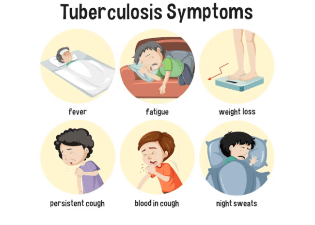 Infografía tuberculosis infantil