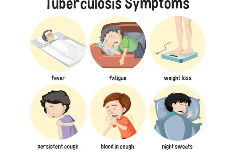 Infografía tuberculosis infantil